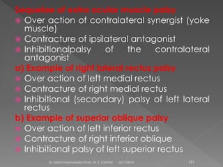 Sequelae of extra ocular muscle palsy
 Over action of contralateral synergist (yoke
muscle)
 Contracture of ipsilateral antagonist
 Inhibitionalpalsy of the contralateral
antagonist
a) Example of right lateral rectus palsy
 Over action of left medial rectus
 Contracture of right medial rectus
 Inhibitional (secondary) palsy of left lateral
rectus
b) Example of superior oblique palsy
 Over action of left inferior rectus
 Contracture of right inferior oblique
 Inhibitional palsy of left superior rectus
6/17/2015Dr. Mohd Najmussadiq Khan, M. S. (Ophth) 131
 