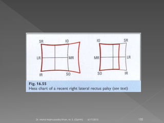 6/17/2015Dr. Mohd Najmussadiq Khan, M. S. (Ophth) 132
 