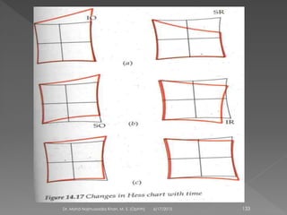 6/17/2015Dr. Mohd Najmussadiq Khan, M. S. (Ophth) 133
 