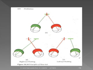 6/17/2015Dr. Mohd Najmussadiq Khan, M. S. (Ophth) 136
 