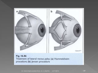6/17/2015Dr. Mohd Najmussadiq Khan, M. S. (Ophth) 139
 