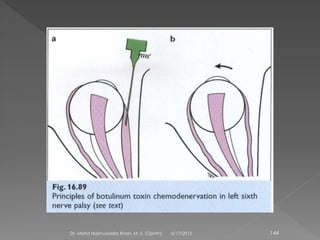 6/17/2015Dr. Mohd Najmussadiq Khan, M. S. (Ophth) 144
 