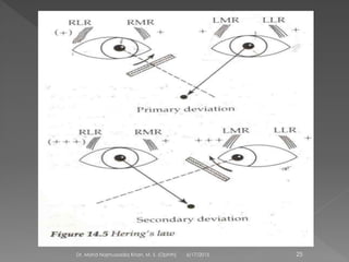 6/17/2015Dr. Mohd Najmussadiq Khan, M. S. (Ophth) 25
 