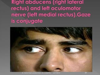 6/17/2015Dr. Mohd Najmussadiq Khan, M. S. (Ophth) 29
 