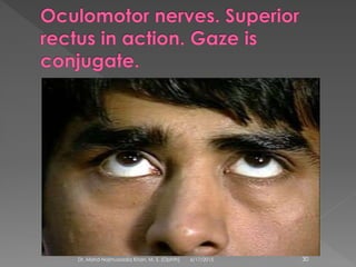 6/17/2015Dr. Mohd Najmussadiq Khan, M. S. (Ophth) 30
 