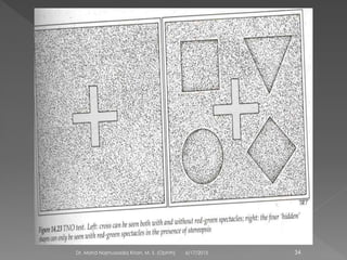 6/17/2015Dr. Mohd Najmussadiq Khan, M. S. (Ophth) 34
 