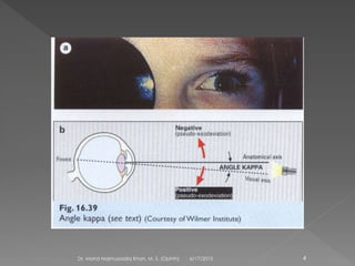 6/17/2015Dr. Mohd Najmussadiq Khan, M. S. (Ophth) 4
 