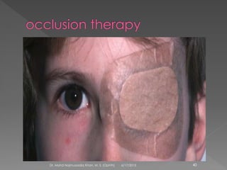 6/17/2015Dr. Mohd Najmussadiq Khan, M. S. (Ophth) 40
 
