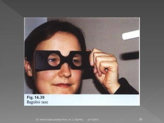 6/17/2015Dr. Mohd Najmussadiq Khan, M. S. (Ophth) 50
 