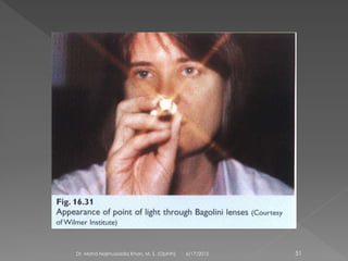 6/17/2015Dr. Mohd Najmussadiq Khan, M. S. (Ophth) 51
 