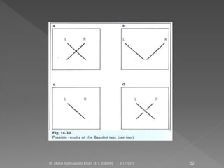 6/17/2015Dr. Mohd Najmussadiq Khan, M. S. (Ophth) 52
 