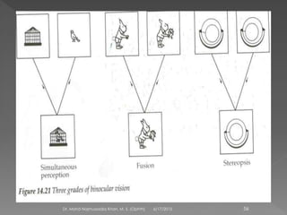 6/17/2015Dr. Mohd Najmussadiq Khan, M. S. (Ophth) 56
 