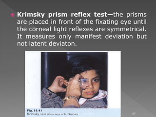  Krimsky prism reflex test—the prisms
are placed in front of the fixating eye until
the corneal light reflexes are symmetrical.
It measures only manifest deviation but
not latent deviaton.
6/17/2015Dr. Mohd Najmussadiq Khan, M. S. (Ophth) 60
 