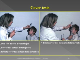 Cover tests
Cover test detects heterotropia • Prism cover test measures total deviatio
Alternate cover test detects total deviation
Uncover test detects heterophoria
6/17/2015Dr. Mohd Najmussadiq Khan, M. S. (Ophth) 64
 