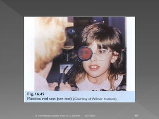 6/17/2015Dr. Mohd Najmussadiq Khan, M. S. (Ophth) 68
 