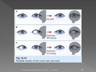 6/17/2015Dr. Mohd Najmussadiq Khan, M. S. (Ophth) 89
 