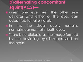  when one eye fixes the other eye
deviates and either of the eyes can
adopt fixation alternately.
 In this the visual acuity remains
normal/near normal in both eyes.
 There is no diplopia as the image formed
by the deviating eye is suppressed by
the brain.
6/17/2015Dr. Mohd Najmussadiq Khan, M. S. (Ophth) 90
 
