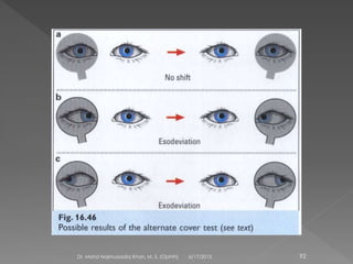 6/17/2015Dr. Mohd Najmussadiq Khan, M. S. (Ophth) 92
 