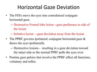 ocular motility disorder wudie.pptx