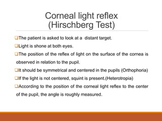 Hirschberg Examples Comprehensive Overview of Ocular Motility, Strabismus, and Amblyopia in ...