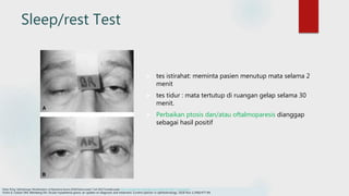 Sleep/rest Test
 tes istirahat: meminta pasien menutup mata selama 2
menit
 tes tidur : mata tertutup di ruangan gelap selama 30
menit.
 Perbaikan ptosis dan/atau oftalmoparesis dianggap
sebagai hasil positif
Edsel, B Ing. Opthalmogic Manifestation of Myastenia Gravis.2018.Disitasi pada 7 Juli 2022.Tersedia pada https://emedicine.medscape.com/article/1216417-overview#a1
Fortin E, Cestari DM, Weinberg DH. Ocular myasthenia gravis: an update on diagnosis and treatment. Current opinion in ophthalmology. 2018 Nov 1;29(6):477-84.
 
