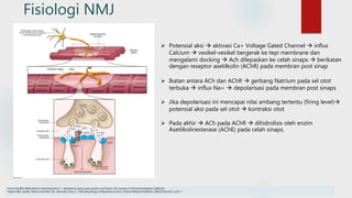 Fisiologi NMJ
 Potensial aksi  aktivasi Ca+ Voltage Gated Channel  influx
Calcium  vesikel-vesikel bergerak ke tepi membrane dan
mengalami docking  Ach dilepaskan ke celah sinaps  berikatan
dengan reseptor asetilkolin (AChR) pada membran post sinap
 Ikatan antara ACh dan AChR  gerbang Natrium pada sel otot
terbuka  influx Na+  depolarisasi pada membran post sinaps
 Jika depolarisasi ini mencapai nilai ambang tertentu (firing level)
potensial aksi pada sel otot  kontraksi otot
 Pada akhir  ACh pada AChR  dihidrolisis oleh enzim
Asetilkolinesterase (AChE) pada celah sinaps.
Conti-Fine BM, Milani,Monica ,Kaminski,Henry J. . Myasthenia gravis: past, present, and future. The Journal of Clinical Investigation 2006;116
Hughes BW, Casillas, Maria Luisa Moro De , Kaminski, Henry J.,. Pathophysiology of Myasthenia Gravis. Thieme Medical Publishers 2004;24 Number 1:p21-7
 