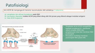 Patofisiologi
Anti-AChR Ab mempengaruhi transmisi neuromuskular oleh setidaknya 3 mekanisme :
(a) pengikatan dan aktivasi komplemen pada NMJ
(b) percepatan degradasi molekul AChR yang diikat silang oleh Ab (proses yang dikenal sebagai modulasi antigenic
(c) blok AChR fungsional
• Pengikatan ab ke AChR mengaktifkan
kaskade komplemen membrane
attack complex (MAC) dan
penghancuran lokal dari membran NMJ
postsinaptik
• Perubahan morfologi membran
postsinaptik NMJ pasien MG
 