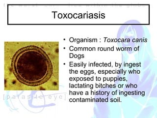 Roundworm In Eye NW2005 Ocular parasites | PPT
