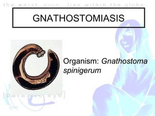 Nw05 Ocular Parasites