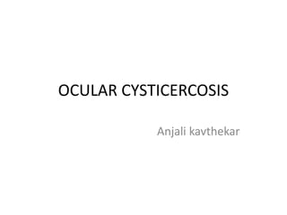 OCULAR CYSTICERCOSIS
Anjali kavthekar
 
