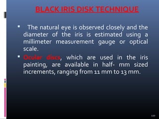 BLACK IRIS DISK TECHNIQUE
 The natural eye is observed closely and the
diameter of the iris is estimated using a
millimeter measurement gauge or optical
scale.
 Ocular discs, which are used in the iris
painting, are available in half- mm sized
increments, ranging from 11 mm to 13 mm.
120
 