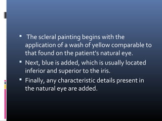  The scleral painting begins with the
application of a wash of yellow comparable to
that found on the patient's natural eye.
 Next, blue is added, which is usually located
inferior and superior to the iris.
 Finally, any characteristic details present in
the natural eye are added.
 
