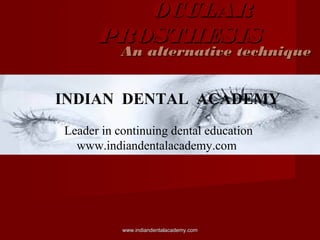 OCULAR
PROSTHESIS

An alternative technique

INDIAN DENTAL ACADEMY
Leader in continuing dental education
www.indiandentalacademy.com

www.indiandentalacademy.com

 