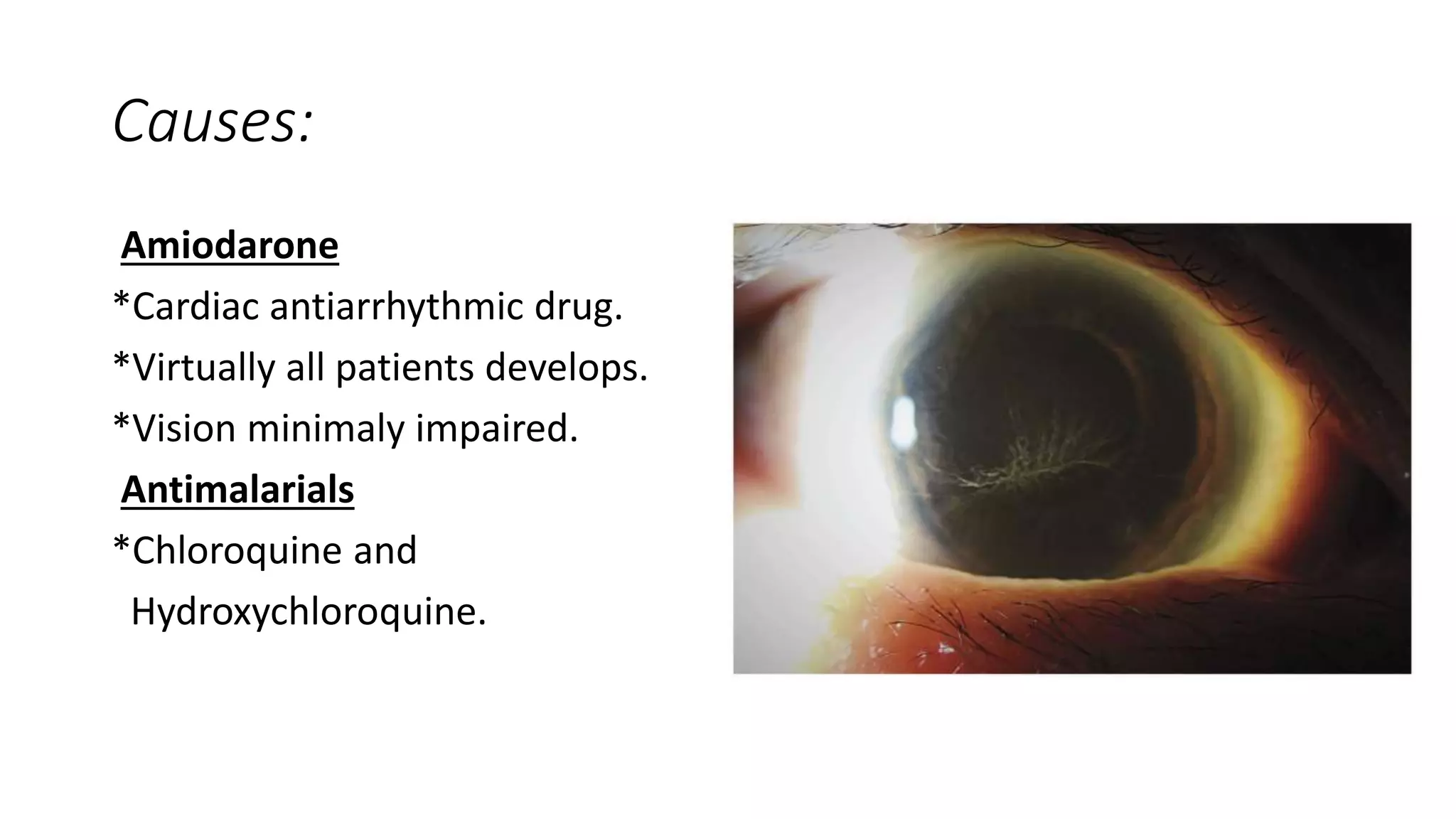 Ocular side effects of medicines | PPTX