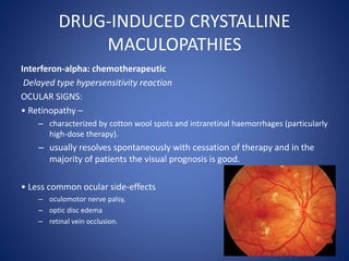 DRUG-INDUCED CRYSTALLINE
MACULOPATHIES
Interferon-alpha: chemotherapeutic
Delayed type hypersensitivity reaction
OCULAR SI...