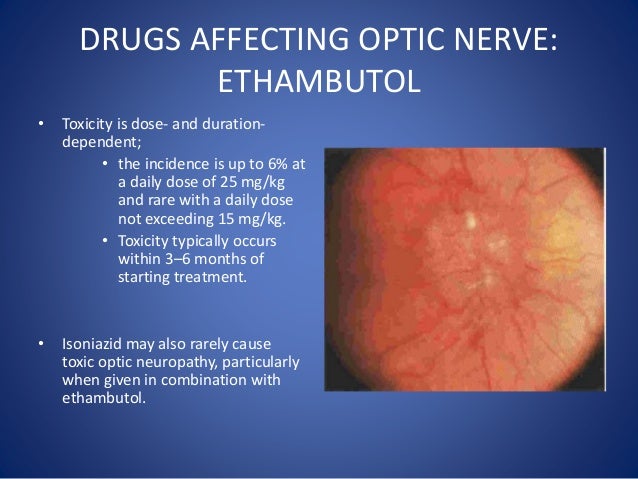 Amiodarone Side Effects Eye