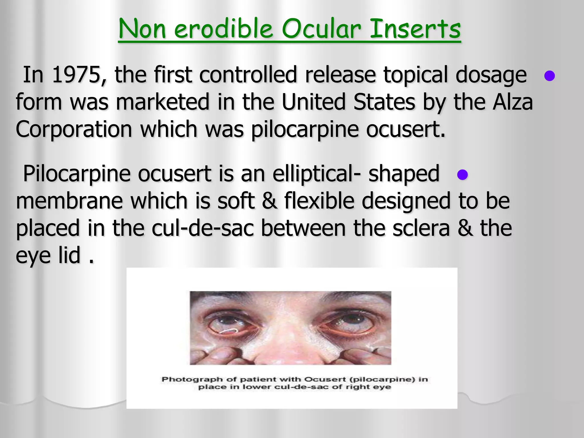 Non erodible Ocular Inserts

In 1975, the first controlled release topical dosage
form was marketed in the United States by the Alza
Corporation which was pilocarpine ocusert.

Pilocarpine ocusert is an elliptical- shaped
membrane which is soft & flexible designed to be
placed in the cul-de-sac between the sclera & the
eye lid .
 