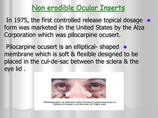 ocular solid dosge form.ppt