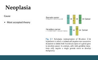 Neoplasia
Cause
• Most accepted theory
 