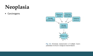 Neoplasia
• Carcinogens
 