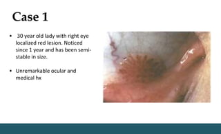 Case 1
• 30 year old lady with right eye
localized red lesion. Noticed
since 1 year and has been semi-
stable in size.
• Unremarkable ocular and
medical hx
 