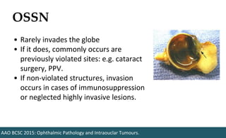 OSSN
AAO BCSC 2015: Ophthalmic Pathology and Intraouclar Tumours.
• Rarely invades the globe
• If it does, commonly occurs are
previously violated sites: e.g. cataract
surgery, PPV.
• If non-violated structures, invasion
occurs in cases of immunosuppression
or neglected highly invasive lesions.
 