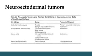 Neuroectodermal tumors
 