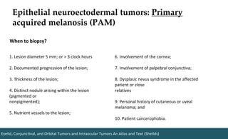 Epithelial neuroectodermal tumors: Primary
acquired melanosis (PAM)
1. Lesion diameter 5 mm; or > 3 clock hours
2. Documented progression of the lesion;
3. Thickness of the lesion;
4. Distinct nodule arising within the lesion
(pigmented or
nonpigmented);
5. Nutrient vessels to the lesion;
6. Involvement of the cornea;
7. Involvement of palpebral conjunctiva;
8. Dysplasic nevus syndrome in the affected
patient or close
relatives
9. Personal history of cutaneous or uveal
melanoma; and
10. Patient cancerophobia.
Eyelid, Conjunctival, and Orbital Tumors and Intraocular Tumors An Atlas and Text (Sheilds)
When to biopsy?
 