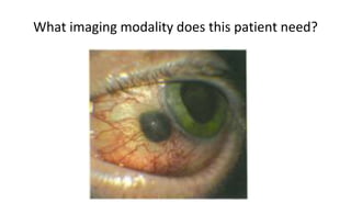 What imaging modality does this patient need?
 