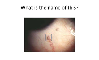 What is the name of this?
 