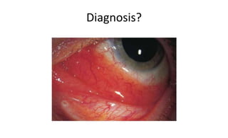 Diagnosis?
 