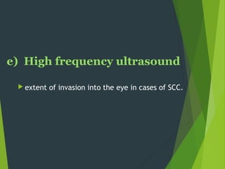 e) High frequency ultrasound
 extent of invasion into the eye in cases of SCC.
 