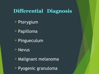Differential Diagnosis
 Pterygium
 Papilloma
 Pingueculum
 Nevus
 Malignant melanoma
 Pyogenic granuloma
 