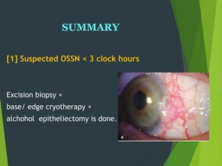 SUMMARY
[1] Suspected OSSN < 3 clock hours
Excision biopsy +
base/ edge cryotherapy +
alchohol epitheliectomy is done.
 